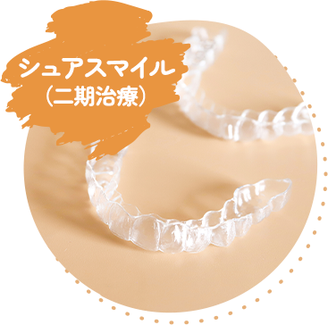 シュアスマイル（二期治療）